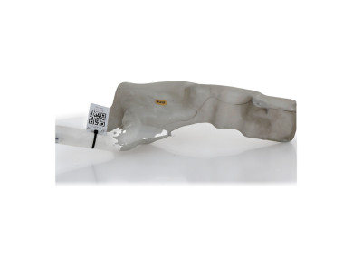 Washer fluid reservoir tank - Ford FIESTA VI PH.2 - 1764300 - L1-9081C